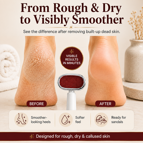 Dual‑Sided Foot Callus Stick
